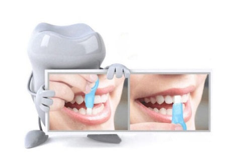 Innovative teeth whitening tool